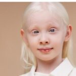 ЖИВОТОТ НА АЛБИНОСИТЕ- МИТОВИ И РЕШЕНИЈА